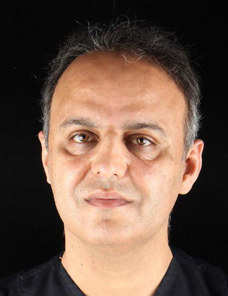 دكتر علی مومن