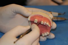 دوره جامع سینوس لیفت همراه با کارگاه عملی دكتر رضا عميد