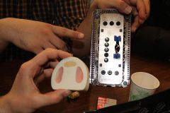 Maxillary Sinus Grafting_3