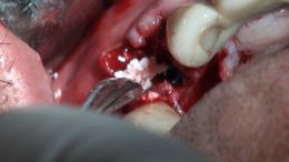 4-5-Mehr-98-Live-Surgery_5