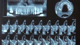 GBR - Course - 2019_1