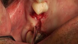 اصول مبانی GBR  - مدرس دکتر عمید