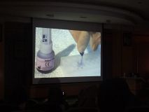 Esthetic crown lengthening_17