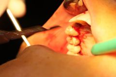 18 th International congress of Iranian association of oral and maxillofacial surgeons_16