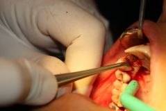 18 th International congress of Iranian association of oral and maxillofacial surgeons_22