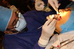 18 th International congress of Iranian association of oral and maxillofacial surgeons_26