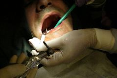 SPI system presentation with live surgery