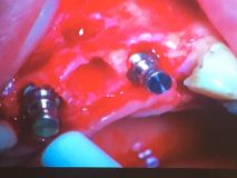 Two days Advanced GBR Training Course_9